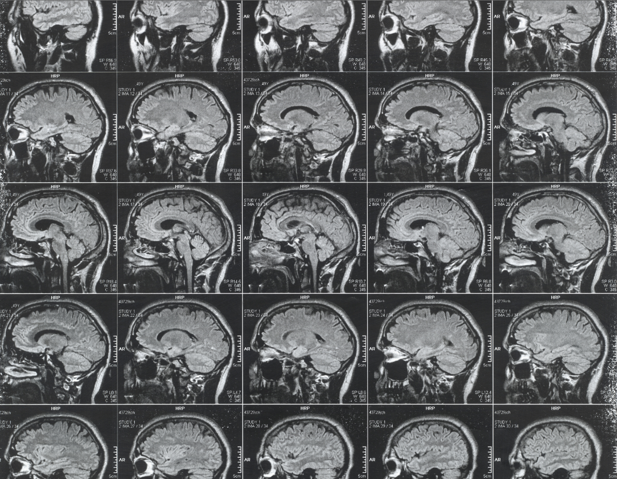 brain ct scan tpool stock4b crop1