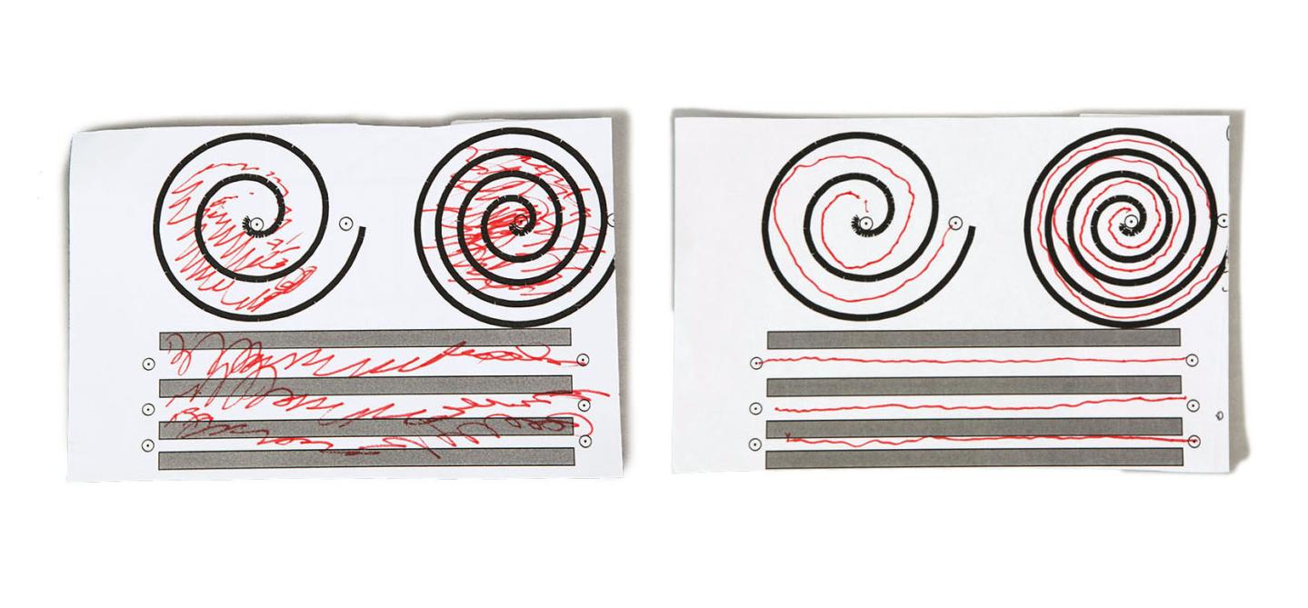 Focused Ultrasound drawing test