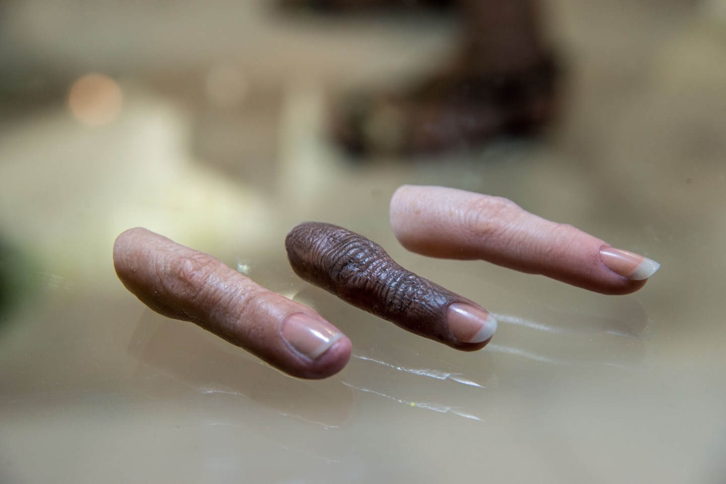 Touch Bionics Unveils New Bionic Hand In Lyon