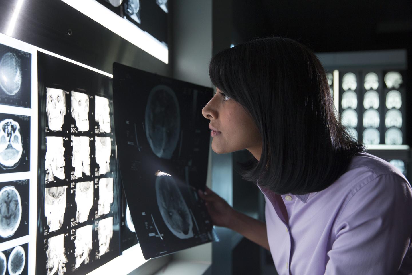 On August 6, 2015 IBM announced that Watson will to gain the ability to "see" by bringing together Watson’s advanced image analytics and cognitive capabilities with data and images obtained from Merge Healthcare Incorporated’s medical imaging management platform.