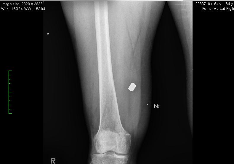 XRAY