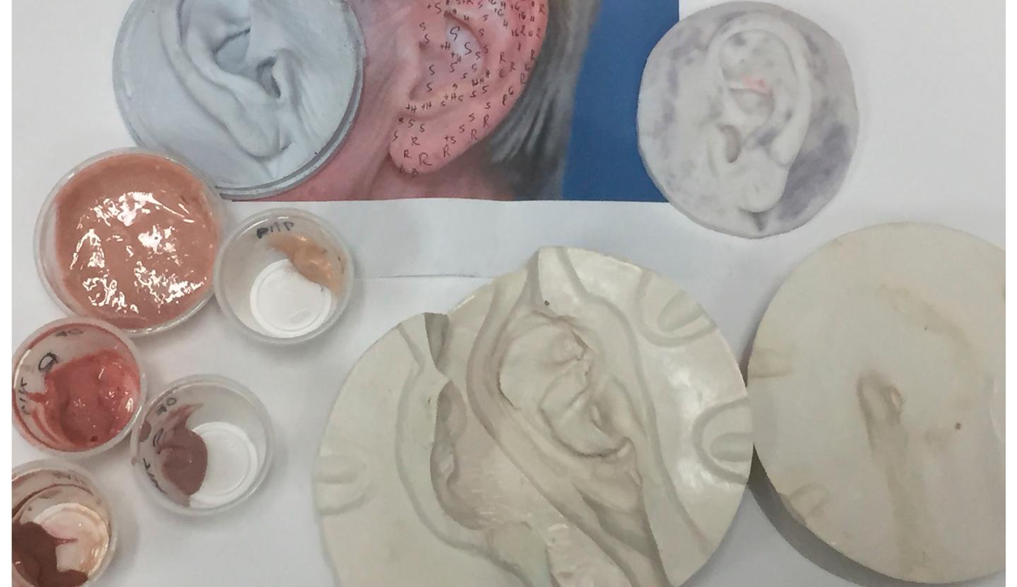 Juan Garcia's mold used to cast an ear prosthesis and the different silicone colors used to paint to match the patient. 