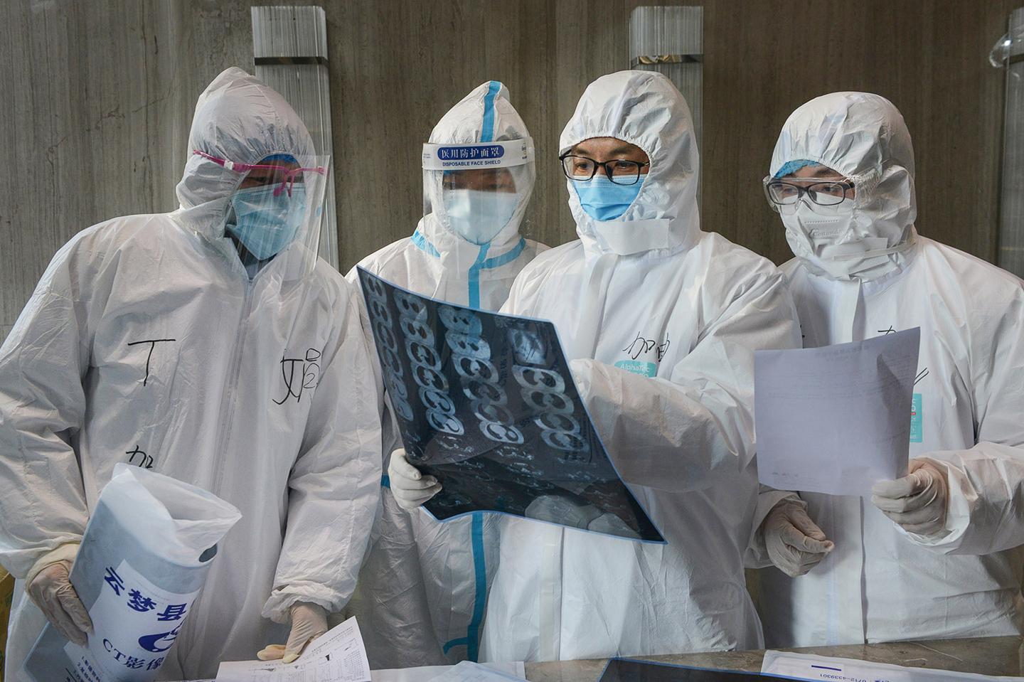 Doctors looking at a lung CT image at a hospital in Yunmeng county, Xiaogan city, in China's central Hubei province, on Feb. 20, 2020.
