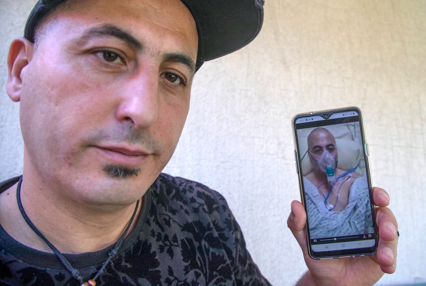 COVID-19-Amirouche-Hammar-France-Patient-Zero