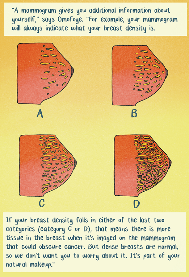 Illustration of different breast density that reads: "If your breast density falls in either of the last two categories (category C or D), that means there is more tissue in the breast when it’s imaged on the mammogram that could obscure cancer. But dense breasts are normal, so we don’t want you to worry about it. It’s part of your natural makeup.”