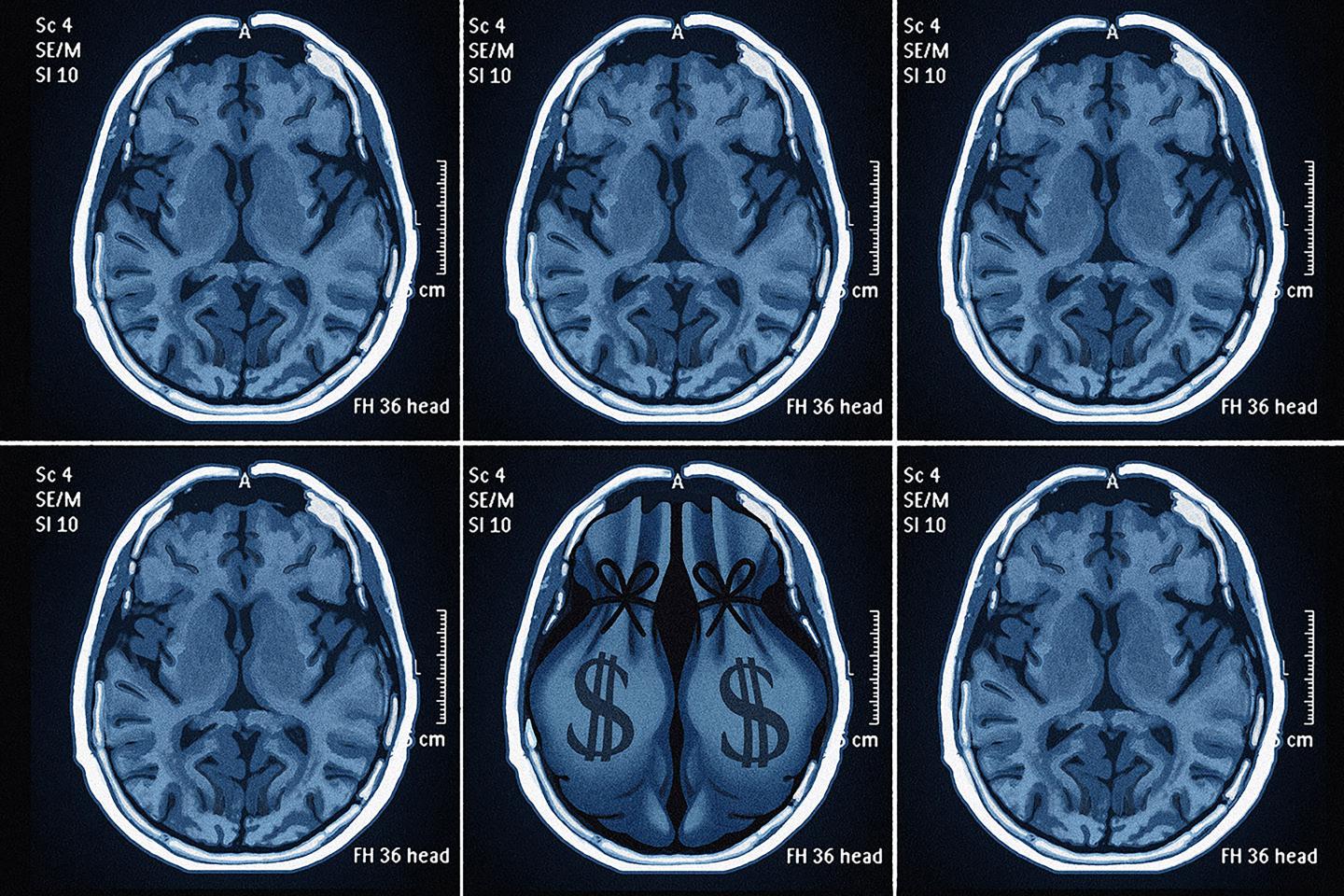 Image of a fanciful MRI scan among five others
